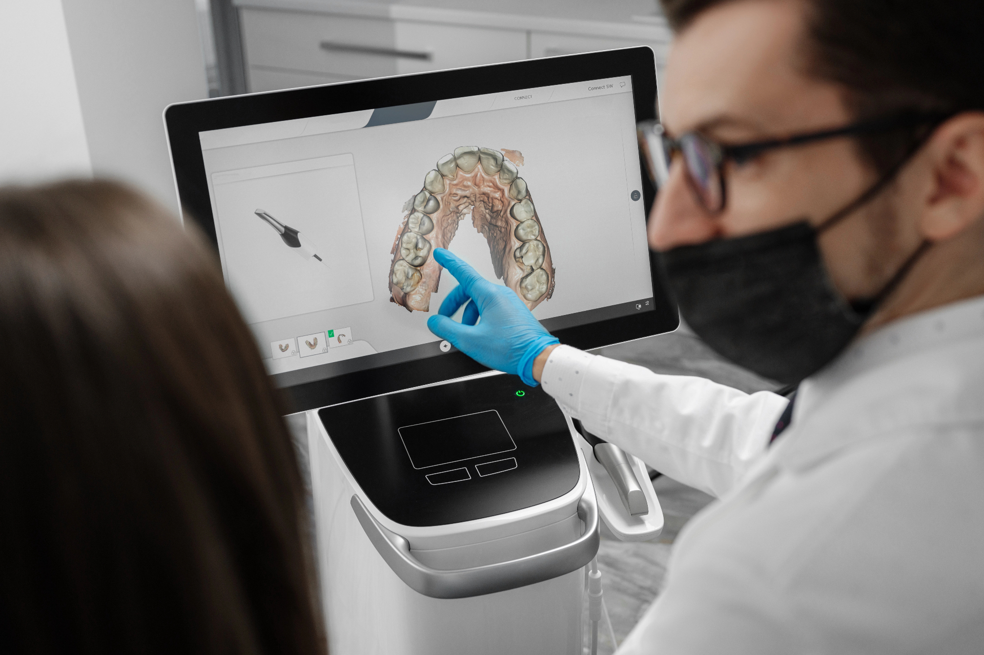 Návrh úsmevu na základe 3D analýzy v štúdiu Fazety Košice